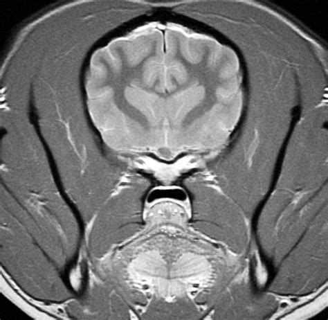 MRI Brain In Situ Transverse Atlas