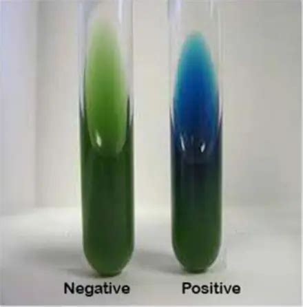 Simmons Citrate Agar | Principle | Preparation | Interpretation