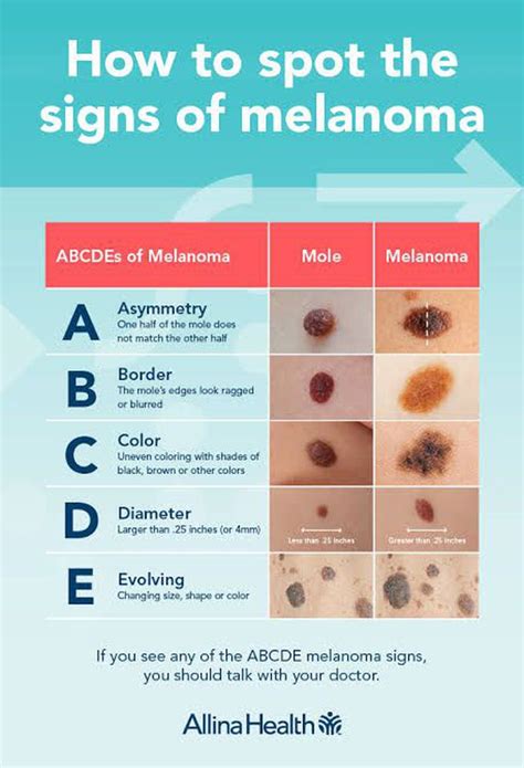 Melanoma - MEDizzy