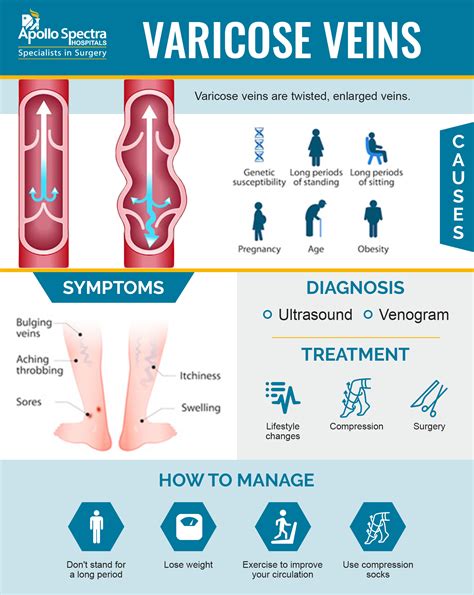 Diagnosing Varicose Veins: Symptoms, Treatment Procedures