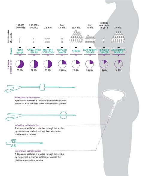 Urinary catheterization