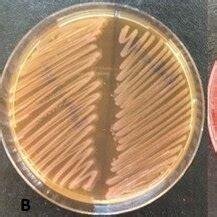 Colony morphology of Proteus spp. on XLD (A), MacConkey (B), and blood ...