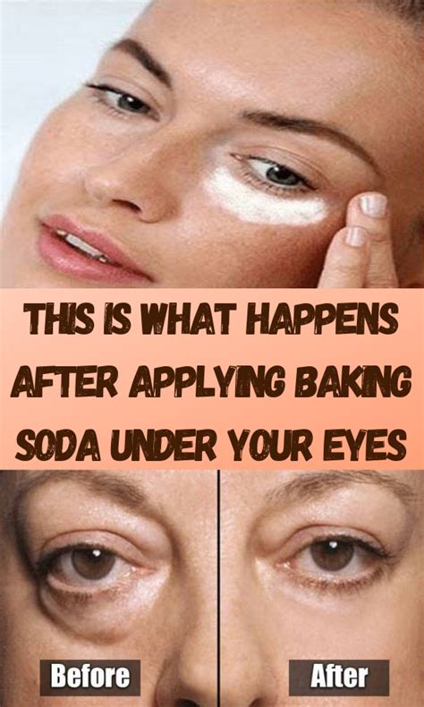 Pin by leslie devol on Health Tips | Puffy eyes remedy, Puffy eyes ...