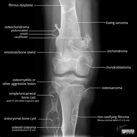 EL RINCÓN DE LA MEDICINA INTERNA. juanpedromacaluso@yahoo.com.ar ...