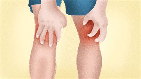 Bilateral Knee Osteoarthritis | Causes, Treatments, And More