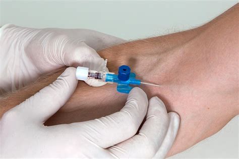 Intravenous Cannulation (IV) — Medistudents