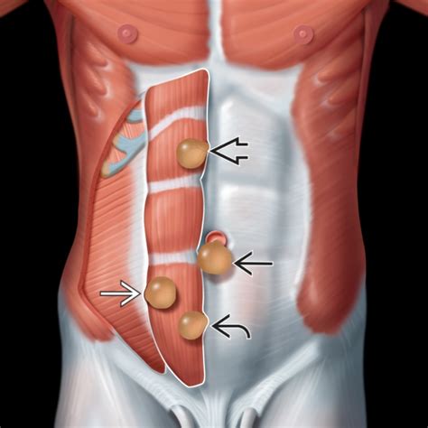 [DIAGRAM] Feather Umbilicus Diagram - MYDIAGRAM.ONLINE