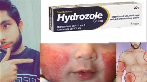 Hydrozole Cream Uses, Benefits, Side Effects, Anti-Fungal, 58% OFF