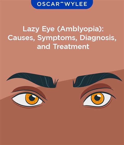 Lazy Eye (Amblyopia): Causes, Symptoms, Diagnosis, and Treatment