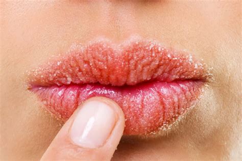 Allergic Reactions on The Lips: Causes and Treatments | LifeMD