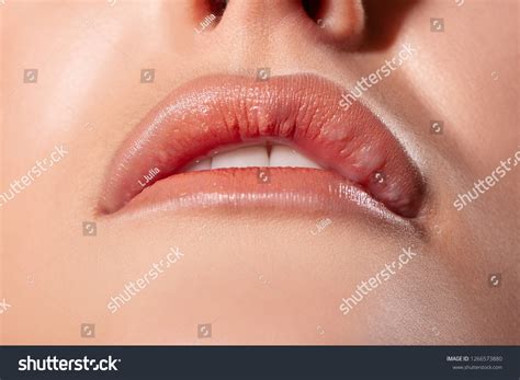 Asymmetry Lips Seals Bumps Lips After Stock Photo 1266573880 | Shutterstock