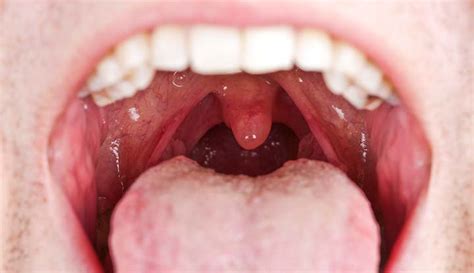 Mouth: Anatomy, Function & Care