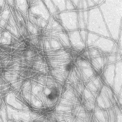 1 Amyloid fibrils and fibrillization kinetics. (A) Negatively stained ...