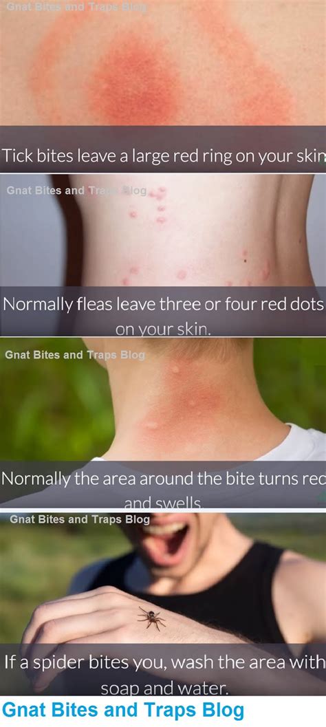 What Bit Me? How to Identify Common Bug Bites? with photos ~ Best ...