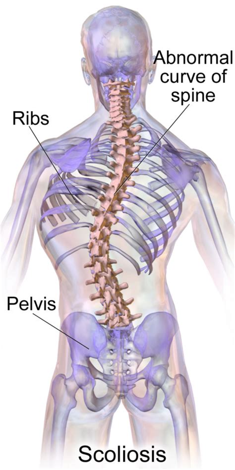 Scoliosis Screening & Treatment in Forked River | Monmouth Pain