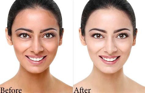 Best Skin Whitening Creams for Dark Skin - Skin Whitening Guides