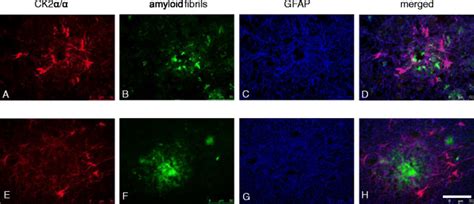 Triple fluorescent stainings of CK2α/α’, amyloid fibrils and astrocytes ...