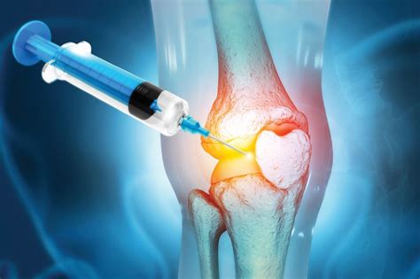 Biodegradable gel shows promise for cartilage regeneration - LISDEL