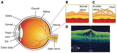 Icelandic Start-Up just raised Money for novel Eye-Drops