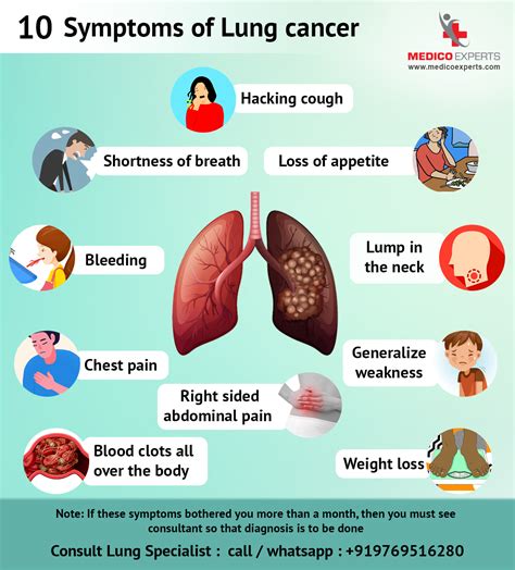 10 Symptoms of Lung cancer - MedicoExperts