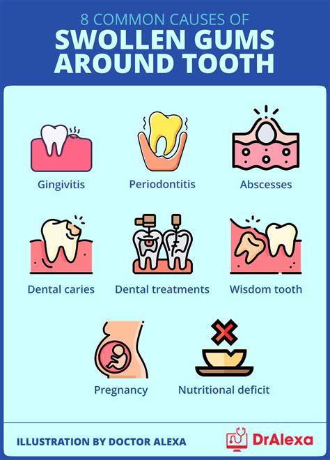 Swollen Gums Around Tooth - Causes and Treatment Options (2023)