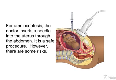 PatEdu.com : Amniocentesis