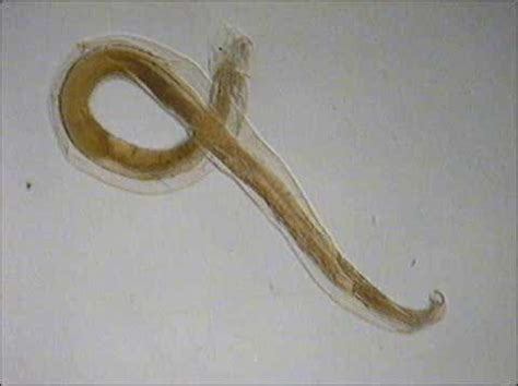 Hookworm