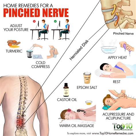 Review Of Pinched Nerve In Neck And Shoulder Treatment At Home References