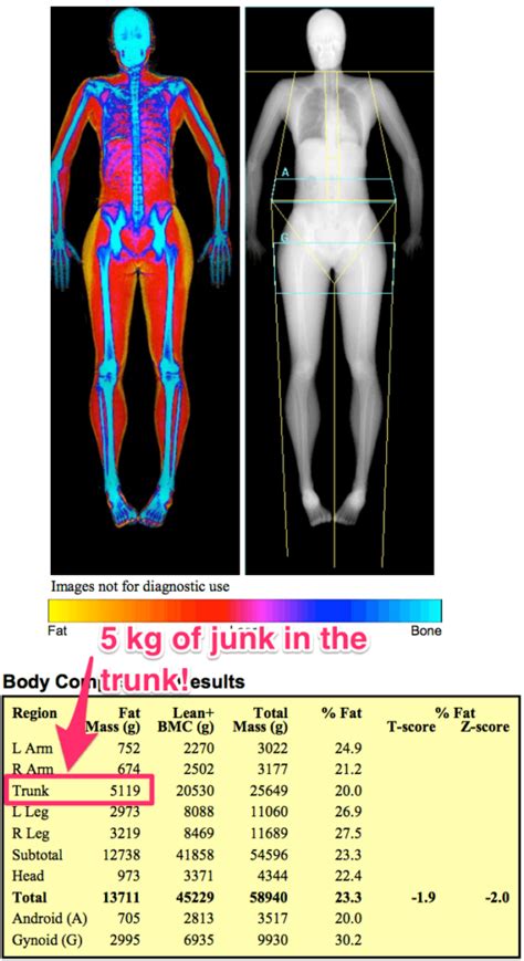 Want to Get Fit? How a DEXA Scan Can Help You Achieve Your Goals