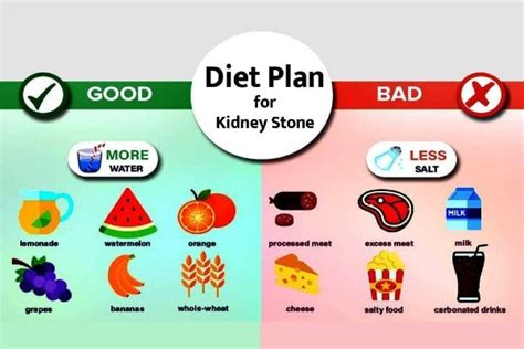 What role does diet have in Kidney Stones?