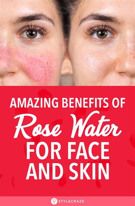 Rose Water For Skin: Benefits, How To Use, And Side Effects