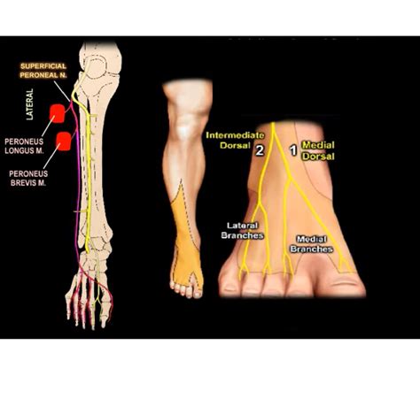 Sciatic Nerve Location Diagram