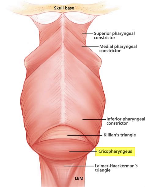 Cricopharyngeal myotomy indications, procedure, complications, recovery ...