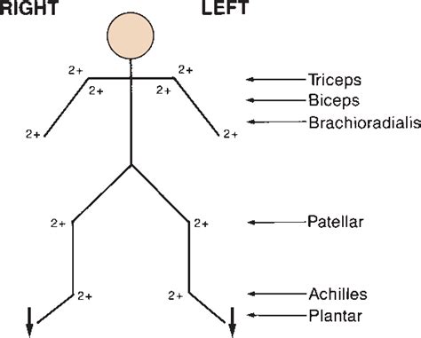 A Tendon Reflex Will Cause Which of the Following Responses