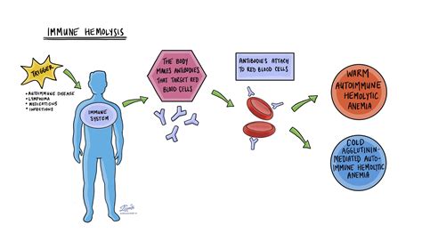 Hemolytic anemia | MyPathologyReport.ca