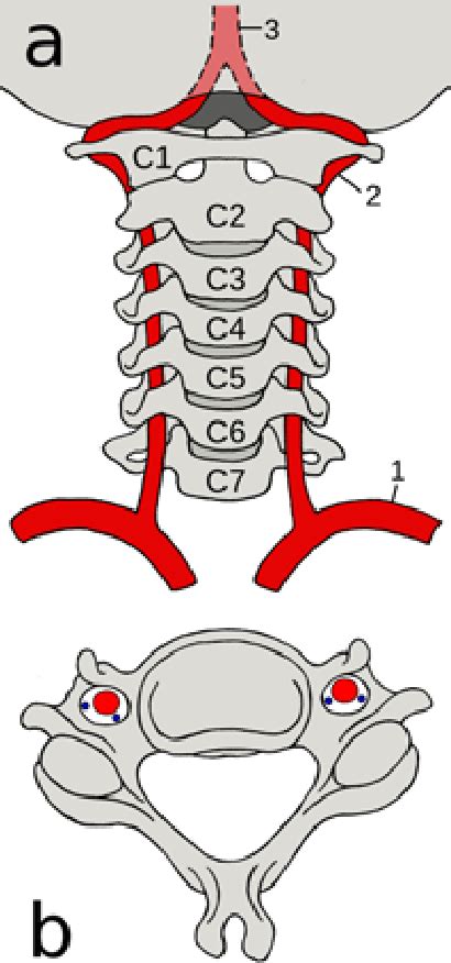 Table 2 from Double transverse foramen in cervical vertebrae in a ...