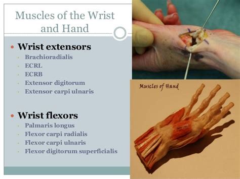 Wrist and Hand - a Review