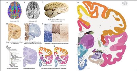 Human brain atlas gets published ... all 350 pages!