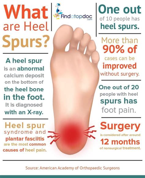 Heel Spur Exercises