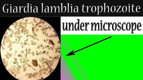 Giardia lamblia trophozoite under microscope (In stool sample) - YouTube