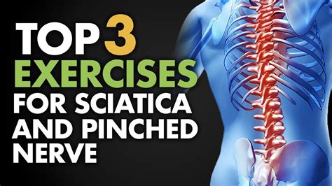 How to Get Rid of Sciatica - Sciatic Nerve Pain Treatment - The Health ...