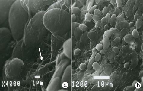 a. Amyloid fibrils (arrow). 4000x. b. Strain E. faecalis. 1200x ...