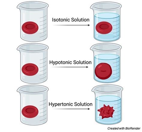 Hypotonic Solution: Definition, Examples, and Importance