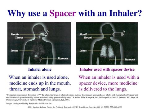 Why you should always use a spacer : r/Asthma