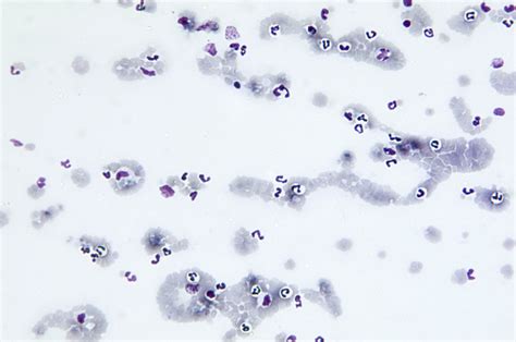 Babesia Canis Bloodsmear Stock Photo - Download Image Now - iStock