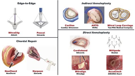 Transcatheter mitral valve repair devices | Download Scientific Diagram