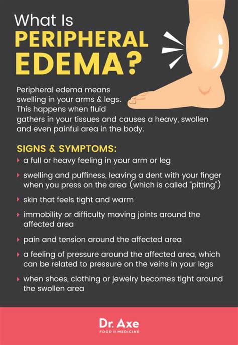 Peripheral Edema: 7 Natural Treatments to Reduce Swelling ...