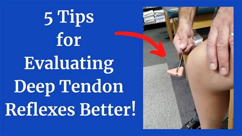 Ace Tips About How To Check Deep Tendon Reflexes - Grantresistance