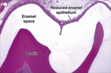 7: Enamel: Composition, Formation, and Structure | Pocket Dentistry