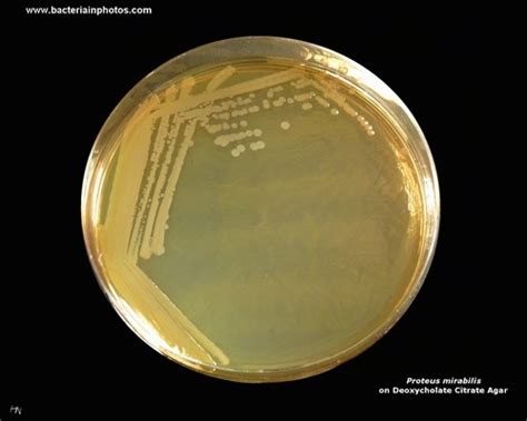 Proteus mirabilis colony morphology - asevaccount